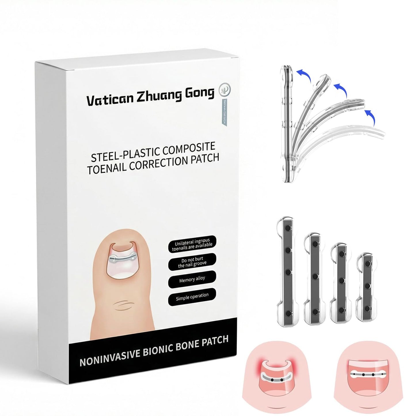 Titanium Alloy Ingrown Toenail Treatment & Removal Kit for Quick Relief, Ingrown Toenail Removal Kit, Professional Ingrown Toenail Corrector, Ingrown Toenail Tools for Quick Relief, 10 Pcs