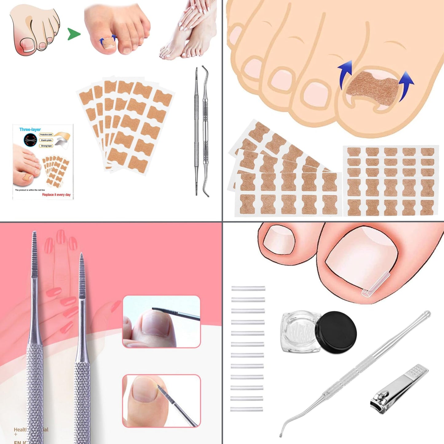 AD ADASTONE Ingrown Toenail Treatment Kit - 16Pcs Professional Ingrown Toenail Corrector with Strips, Patches & Pads - Medical Grade Ingrown Toenail Removal Tool for Painless Pedicure Recovery
