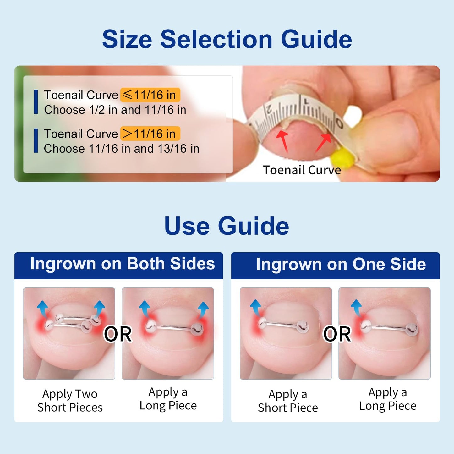 Nitinol Ingrown Toenail Corrector,at Home Ingrown Toenail Treatment,Curved Toenail Straightener,Ingrown Toe Nail Relief,Ingrown Toenail Removal Kit (1/2 In,11/16 In)