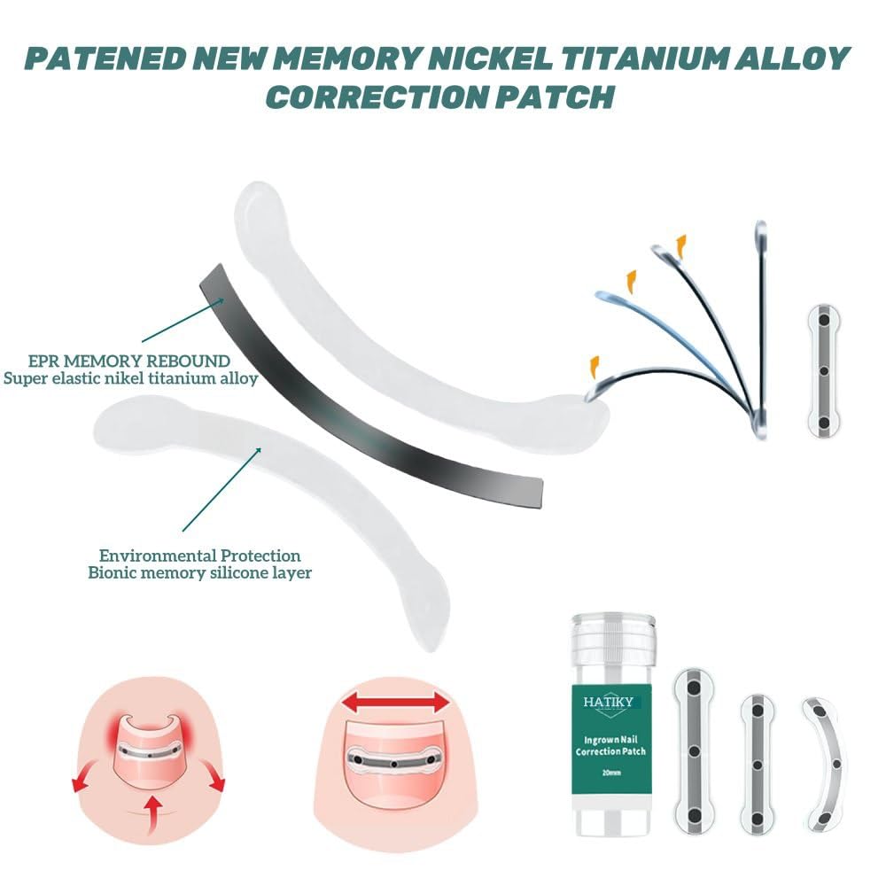 Ingrown Toenail Corrector & Removal Kit - at Home Treatment for Ingrown Toenails, Titanium Alloy Ingrown Toenail Treatment Tools, Nail Tools Designed for Curved Nail Repair Suitable for Men Woman