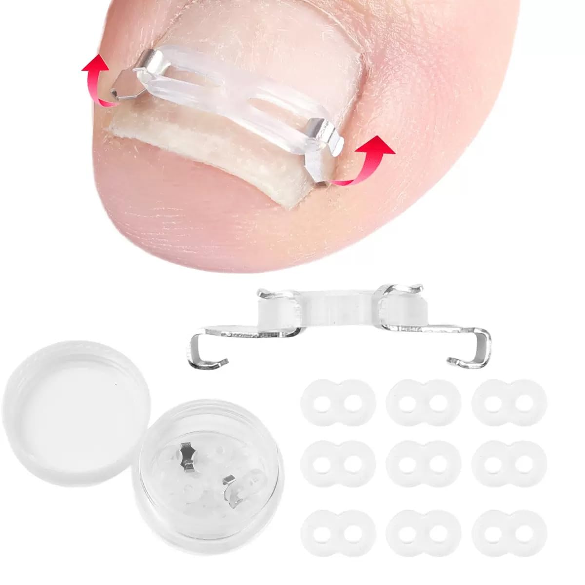 Zanchara Ingrown Toenail Corrector Kit for Men Women - Ingrown Nail Tool - 2 Stainless Steel Clips- Curved Nail Strips & Toe Pads for Embedded/Curled Nails