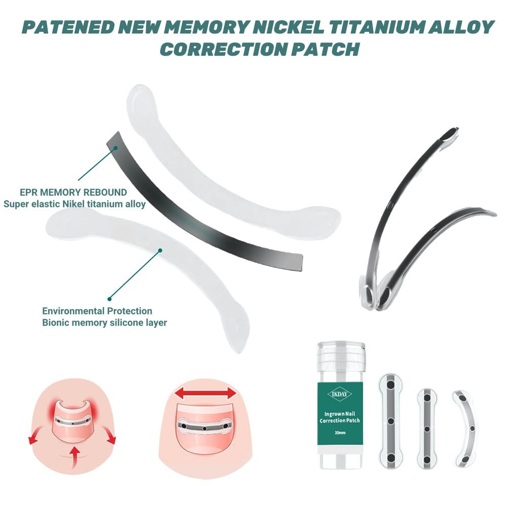 Ingrown Toenail Treatment & Removal Kit - at Home Treatment for Ingrown Toenails, Titanium Alloy Ingrown Toenail Corrector, Nail Tools for Curved Nail Repair Suitable for Men Woman (((0.67/0.79in)))