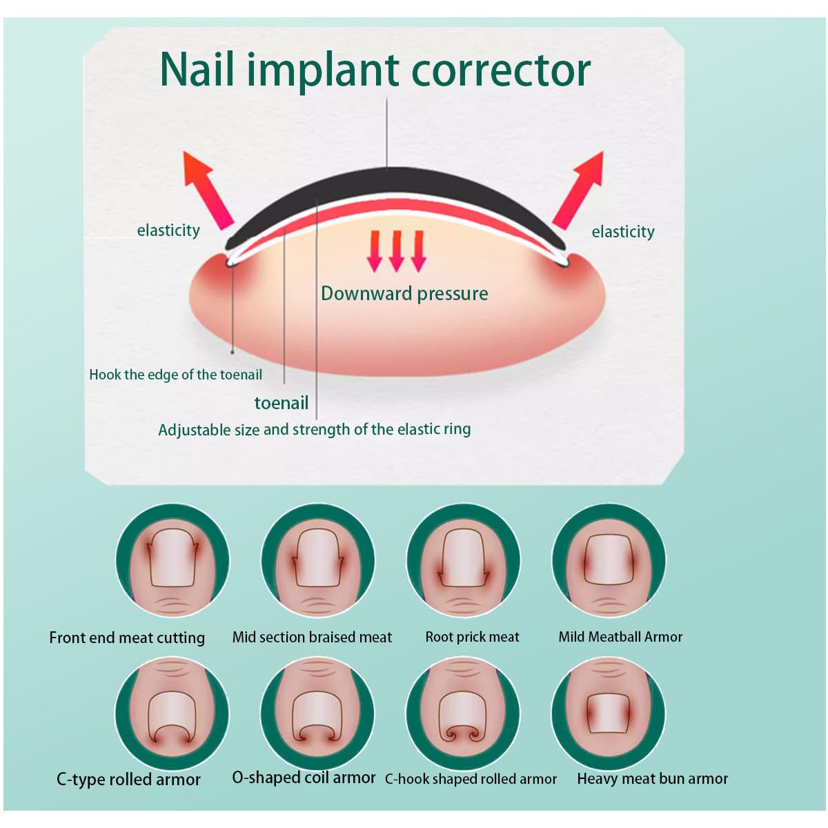 JIUDOUCUOIngrown Toenail correction Kit, Professional Nail Care Tools with Correction Clips and Adhesive Pads，Four correction clips can correct two toenails simultaneously
