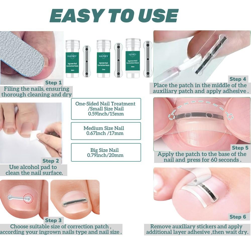 Ingrown Toenail Corrector & Removal Kit - at Home Treatment for Ingrown Toenails, Titanium Alloy Ingrown Toenail Treatment Tools, Nail Tools Designed for Curved Nail Repair Suitable for Men Woman