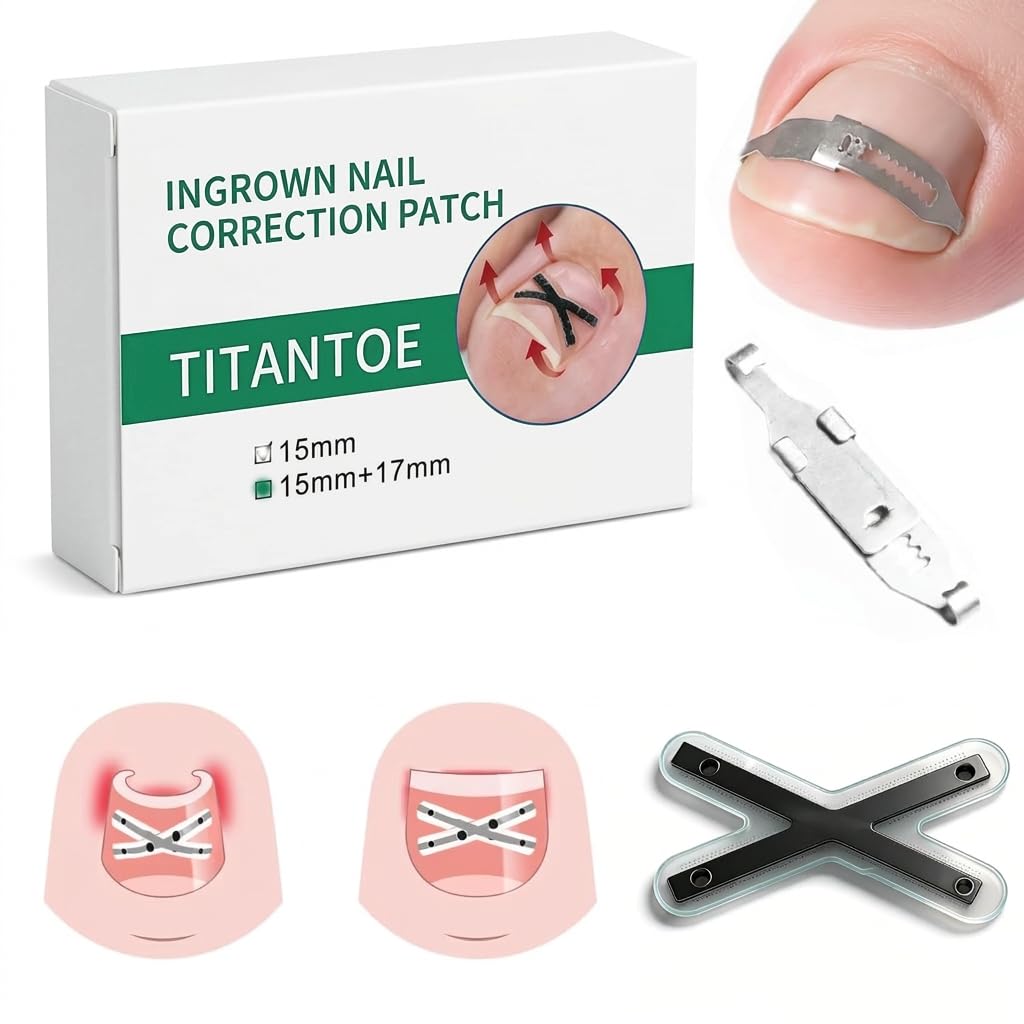 CHGRNLF Ingrown Toenail Treatment Kit, Titanium Alloy Ingrown Toenail Corrector Strips for Big Toe, Toenail Curve Corrector & Straightener for Curled Nails, At-Home Ingrown Nail Pain Relief, 6Pcs