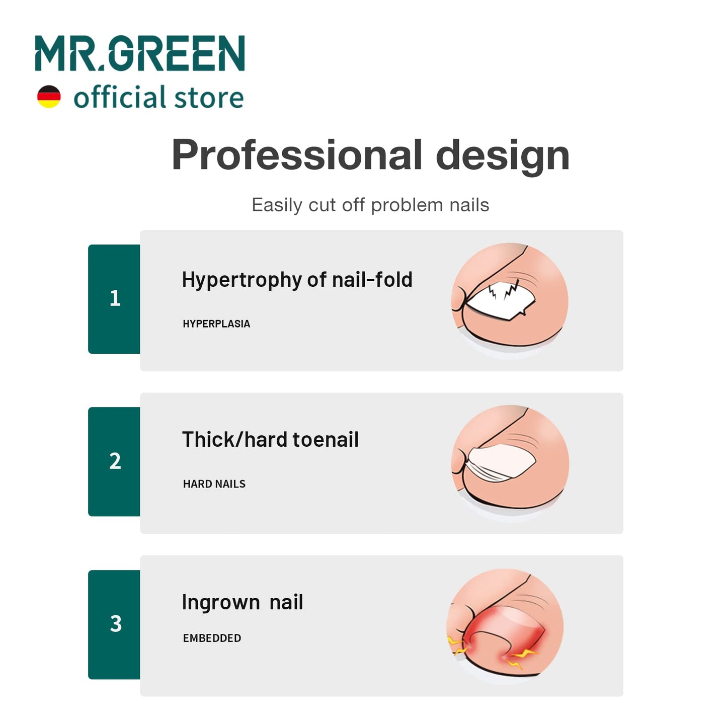 MR.GREEN Toenail Clippers Stainless Steel Ingrown Nail Cutter Thick and Hard Nails Pedicure Manicure Tools (Orange+Nail Remover)