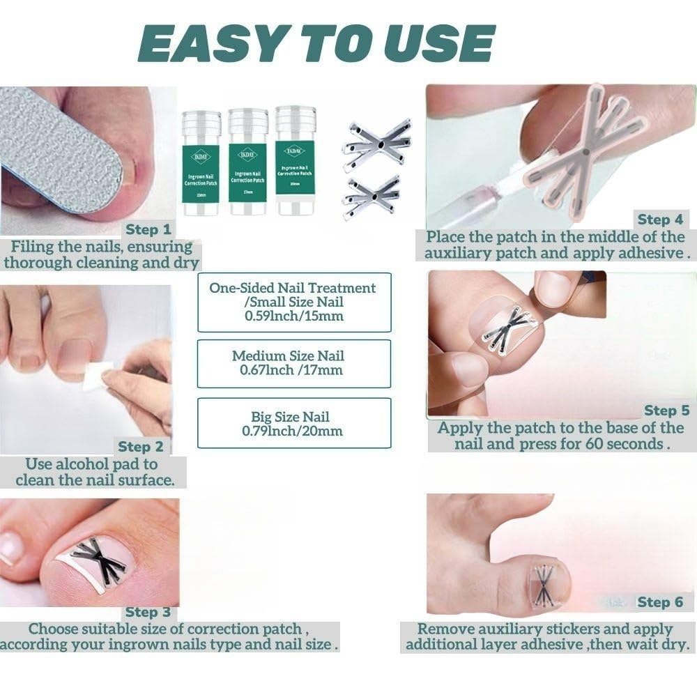 Ingrown Toenail Treatment & Removal Kit (New 6X Tension) at Home Treatment for Toenails,Titanium Alloy Ingrown Toenail Corrector, Nail Tools for Curved Nail Repair for Men Woman (0.67/0.79in)