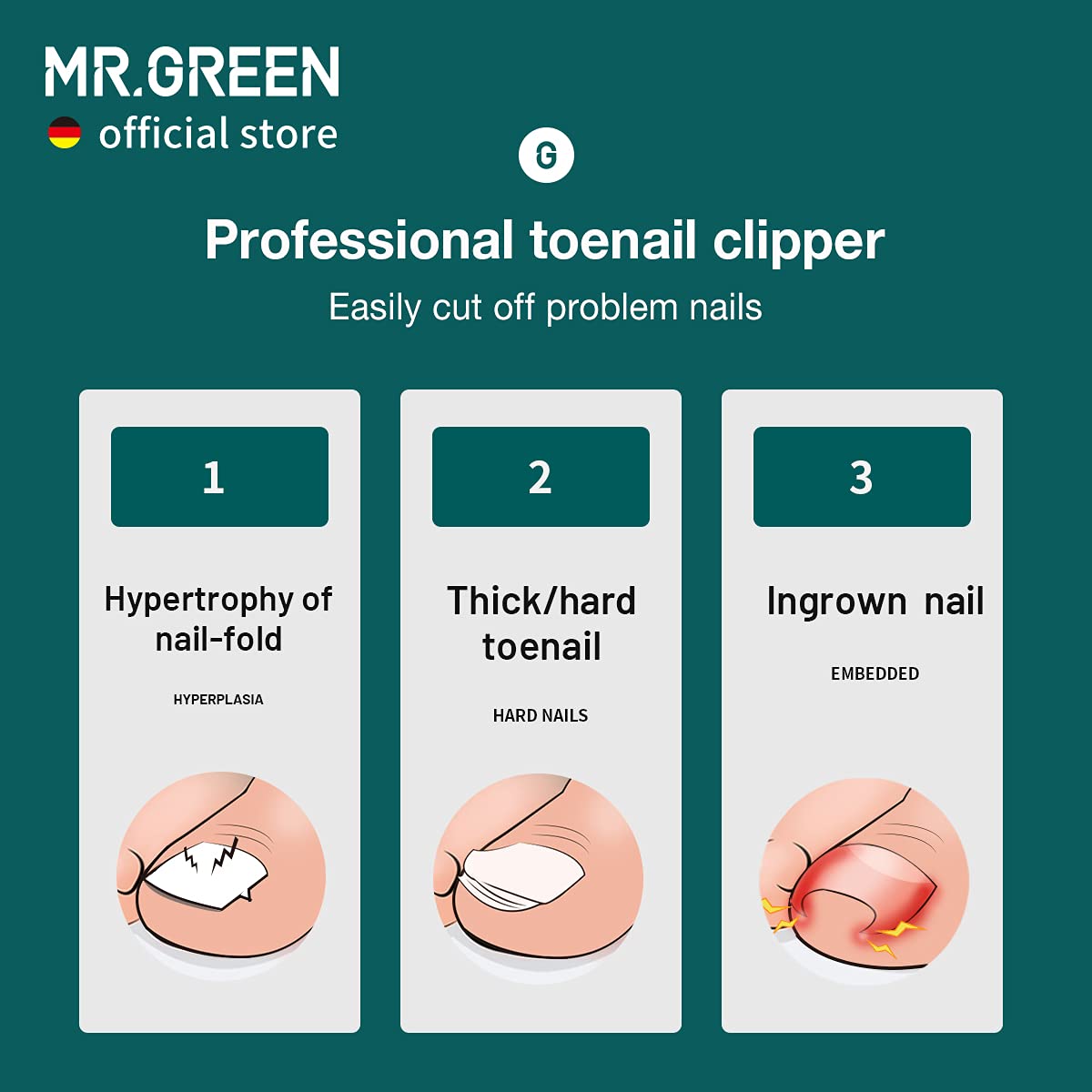 MR.GREEN Nail Clippers Toenail Cutters Anti-Splash Professional Ingrown Thick Hard Nail Scissors Pedicure Tools Manicure Sets (Orange Handle+Nail Remover)