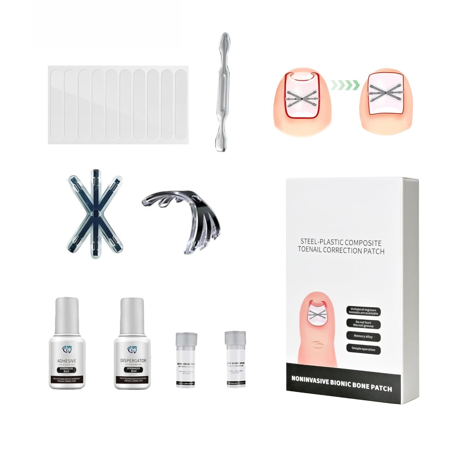 Titanium Alloy Ingrown Toenail Treatment 3X Stronger Pulling Force, Nail Tools and Ingrown Toenail Repair Kit for Curved & Thick Nails, Professional Foot Care Solution for Men & Women (0.63/0.67 in)