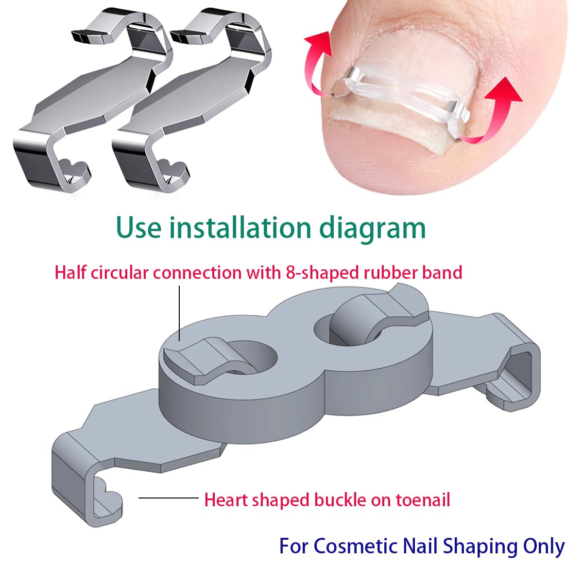 JIUDOUCUOIngrown Toenail correction Kit, Professional Nail Care Tools with Correction Clips and Adhesive Pads，Four correction clips can correct two toenails simultaneously