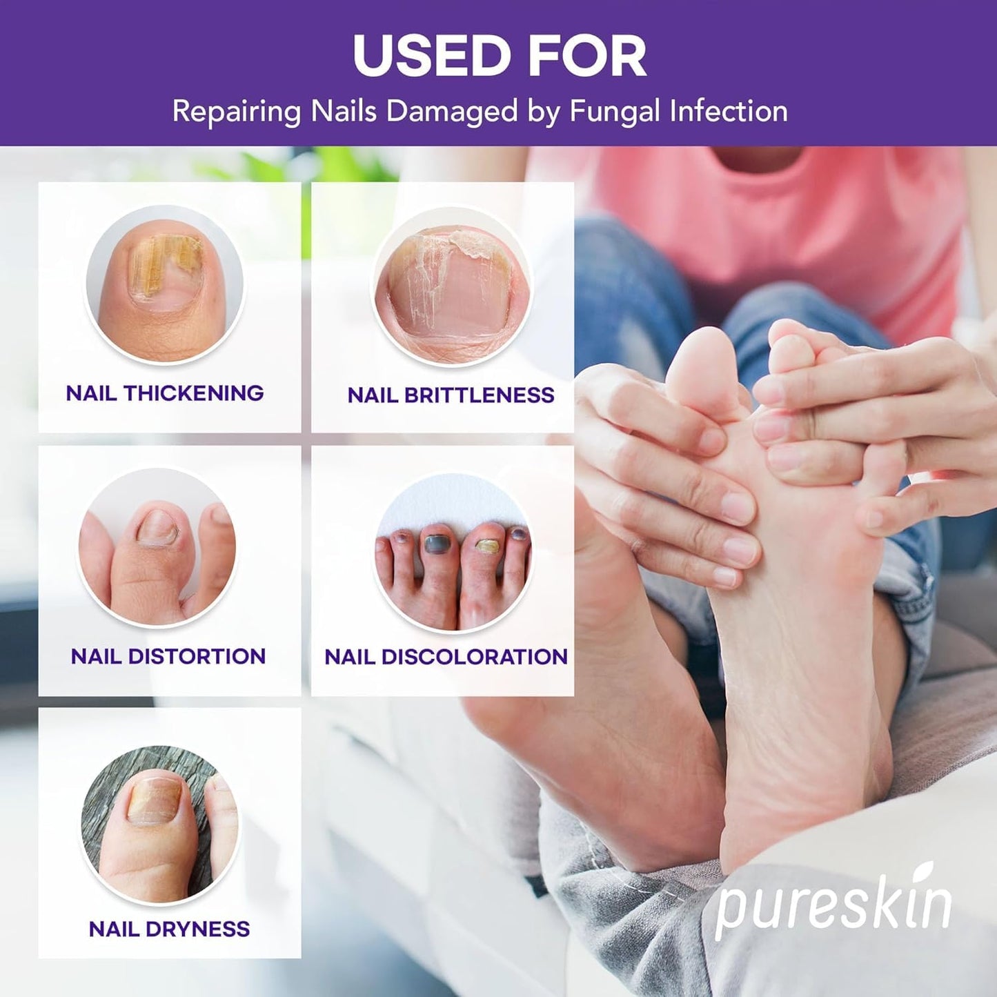 Extra Strength Toenail Fungus Treatment Patches: Nail Fungus Treatment for Toenail Fingernails - Nighttime Fungal Nail Patches Fungal Nail Repair- 21 patches