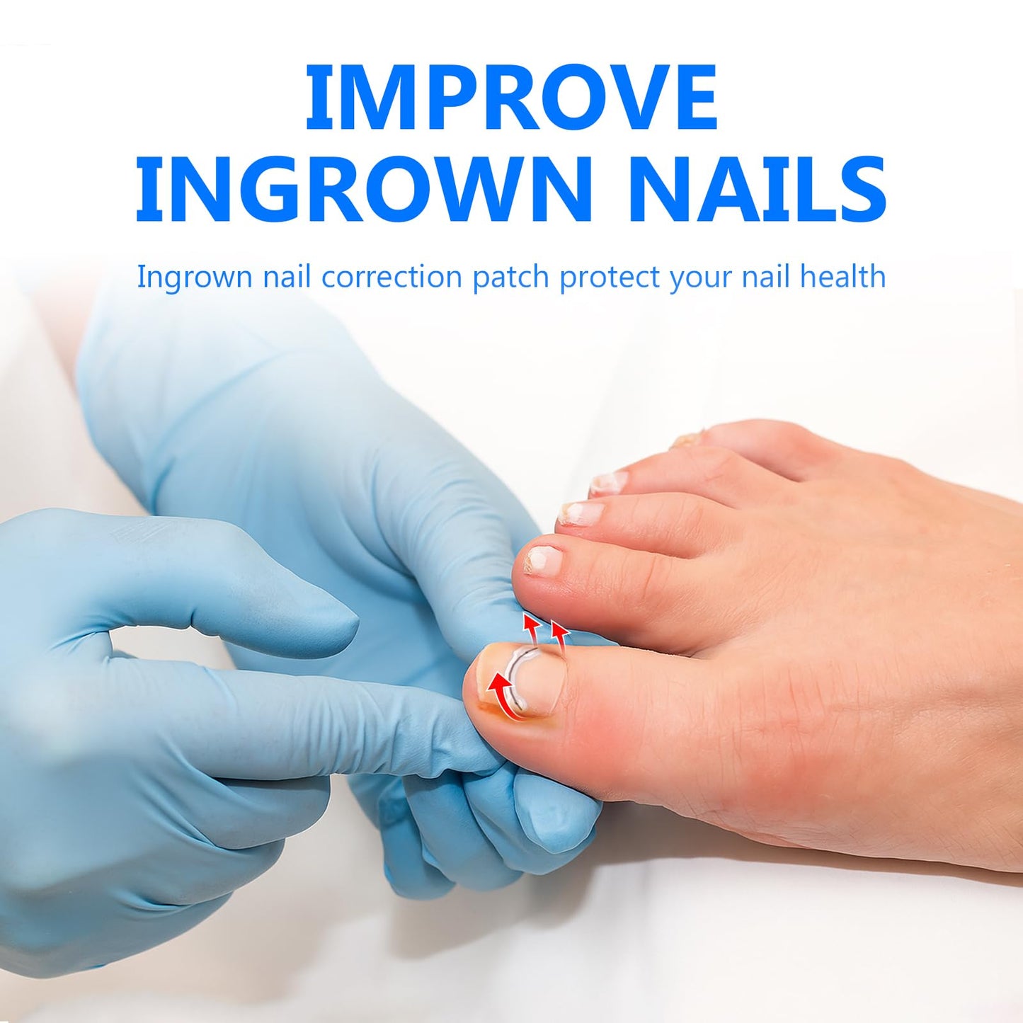 Ingrown Toenail Treatment, Toenail Correction Strips for Curved or Ingrown Nails, Ingrown Toe Nail Relief Remover Strips, Quick Relief, Nail Correction, 5 Different Sizes