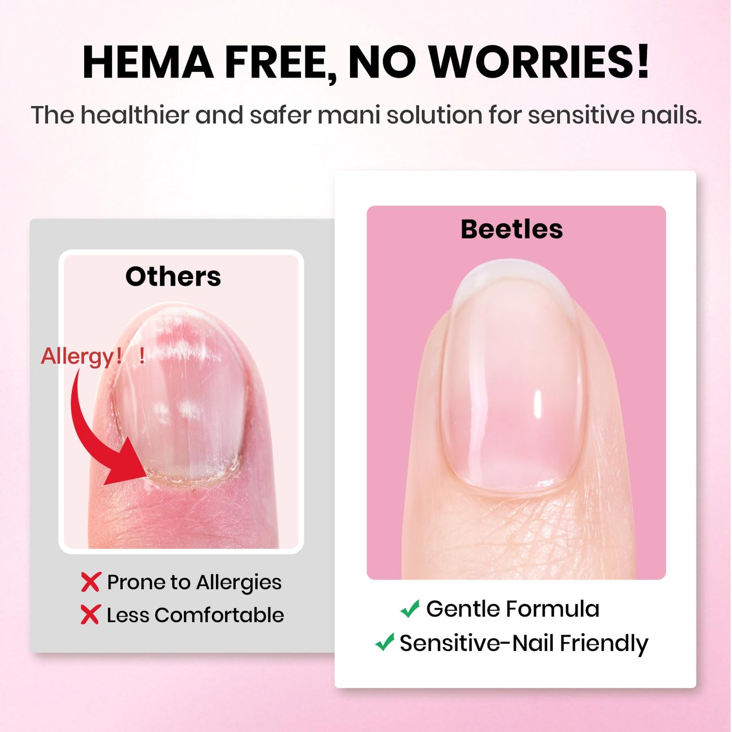 Beetles Gel Nail Kit Etch-X, Medium Almond, 288pcs 12 Sizes Nail tips, 3Pcs 15ml HEMA-Free Nail Glue Top Coat &Base Gel Set, for Acrylic and Clear Press On Nail, Long Lasting Extension DIY Set at Home