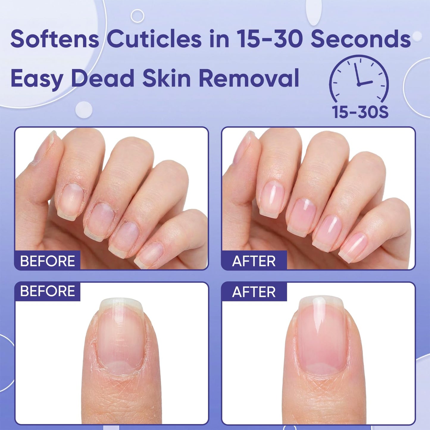 SASSYTIP Cuticle Care Kit - Cuticle Remover Gel (1oz) & Ceramic Pusher with Nourishing Oil Pen (2ml). Complete At-Home Manicure & Pedicure Set for Dry & Damaged Nails. Salon Results (Gel+Pink Pen)