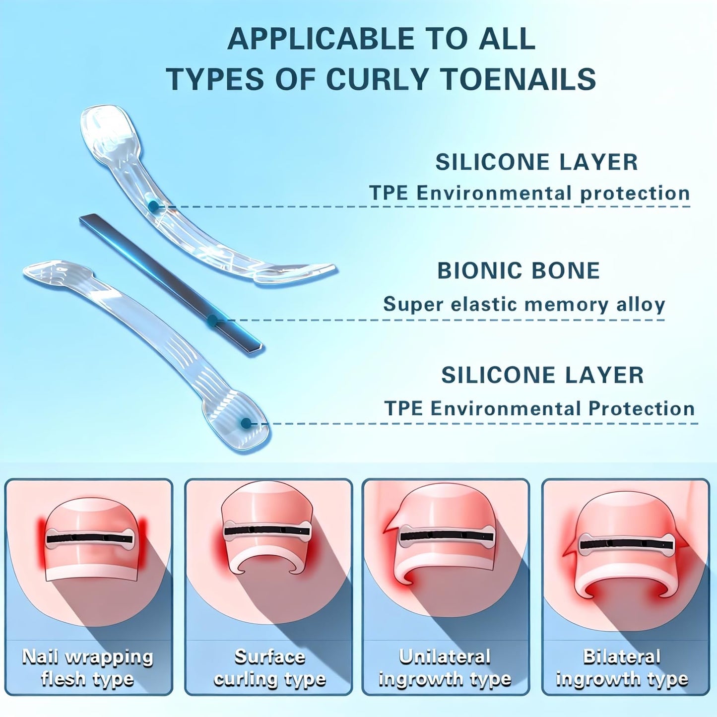 Titanium Alloy Ingrown Toenail Treatment - Professional Home Care for Curved Nails - Waterproof, Nail Tools and Ingrown Toenail Removal Kit,Ingrown Toenail Corrector(0.59/0.67in)