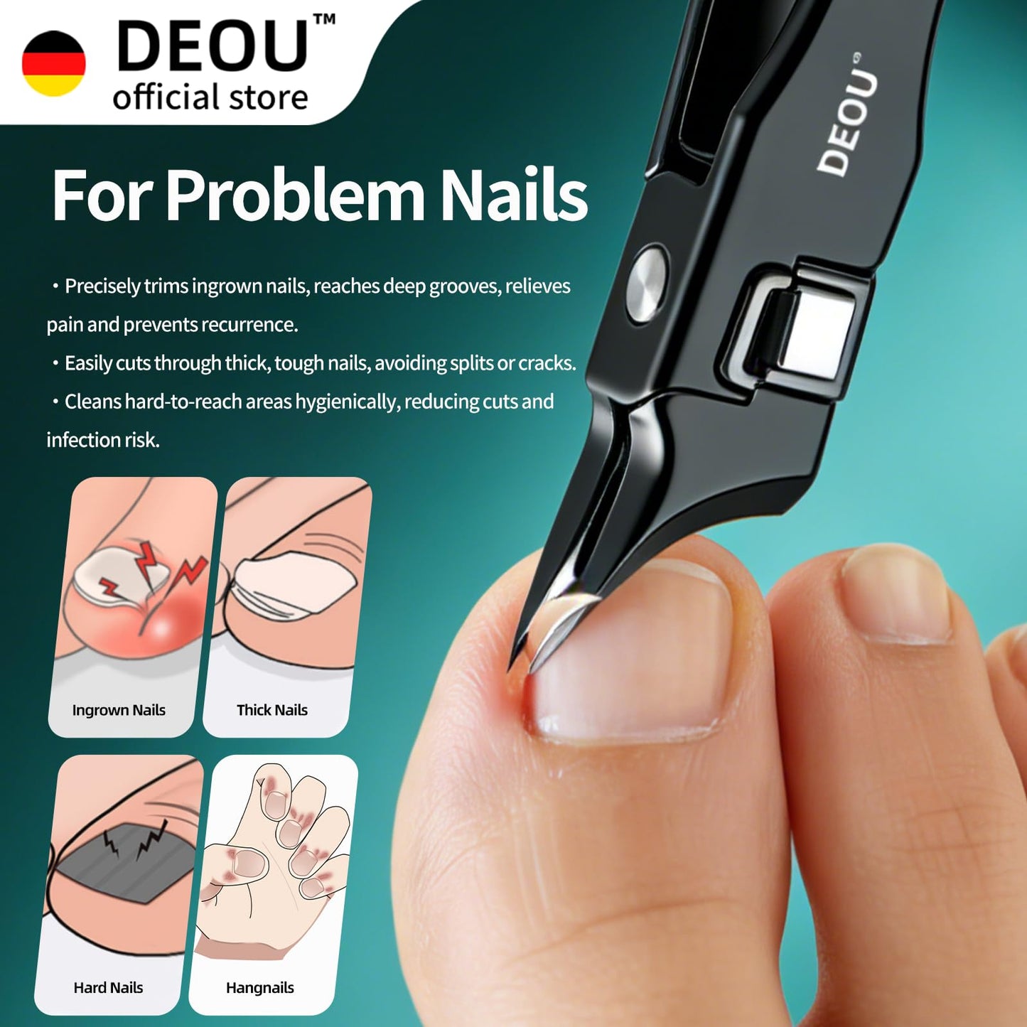 DEOU Ingrown Toenail Clippers with Nail File, Premium Stainless Steel Oblique Cutter, Anti-Splash One-Piece Casting, Manicure Tool with Keyhole, Gift Box for Thick/Hard/Fungal Nails