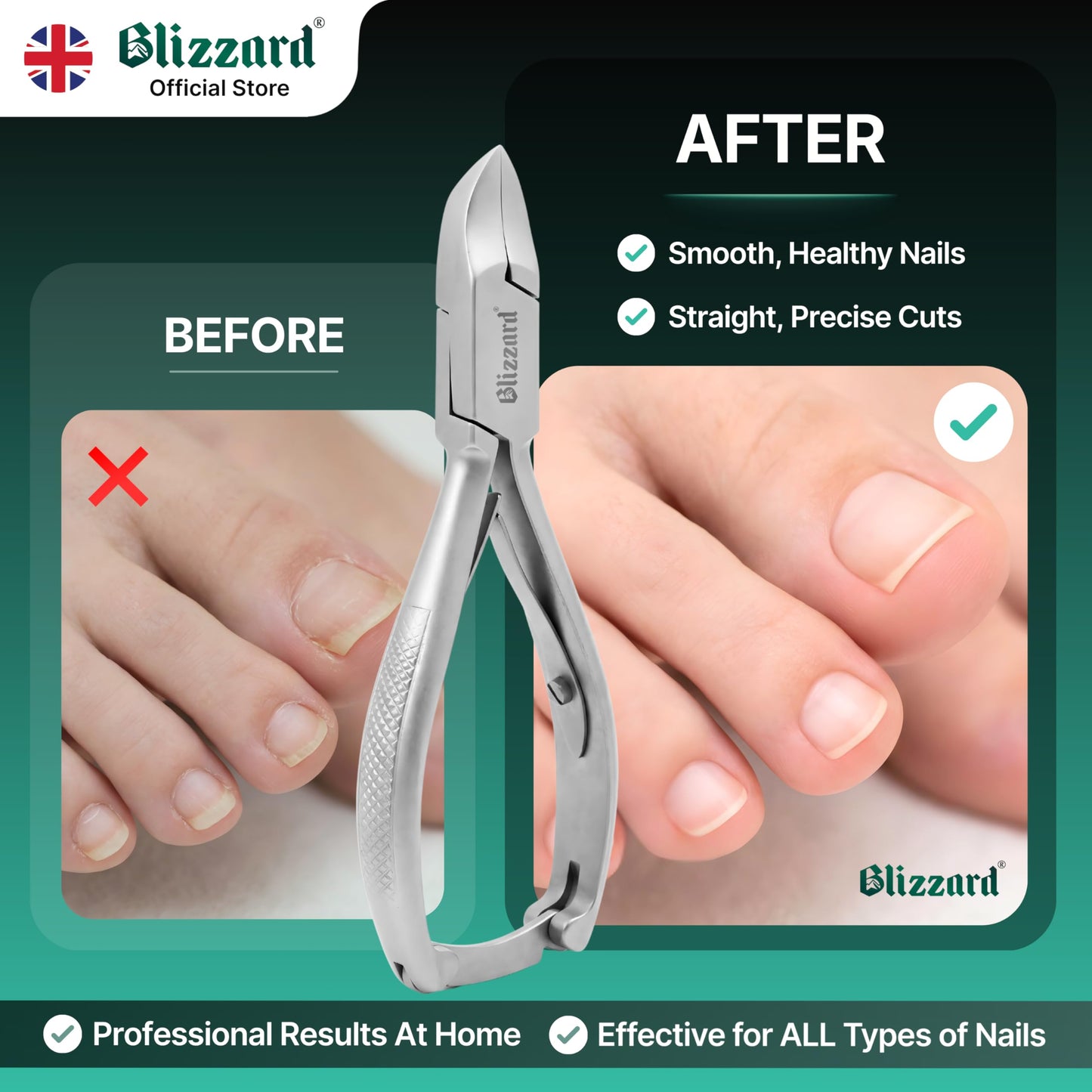 Blizzard Toenail Clippers - Podiatrist Toe Nail Clippers for Thick Nails for Seniors - German Forged Nail Cutter - Heavy Duty Nail Clippers for Men with Toenail File - 5.5" Concave Head, Double Spring