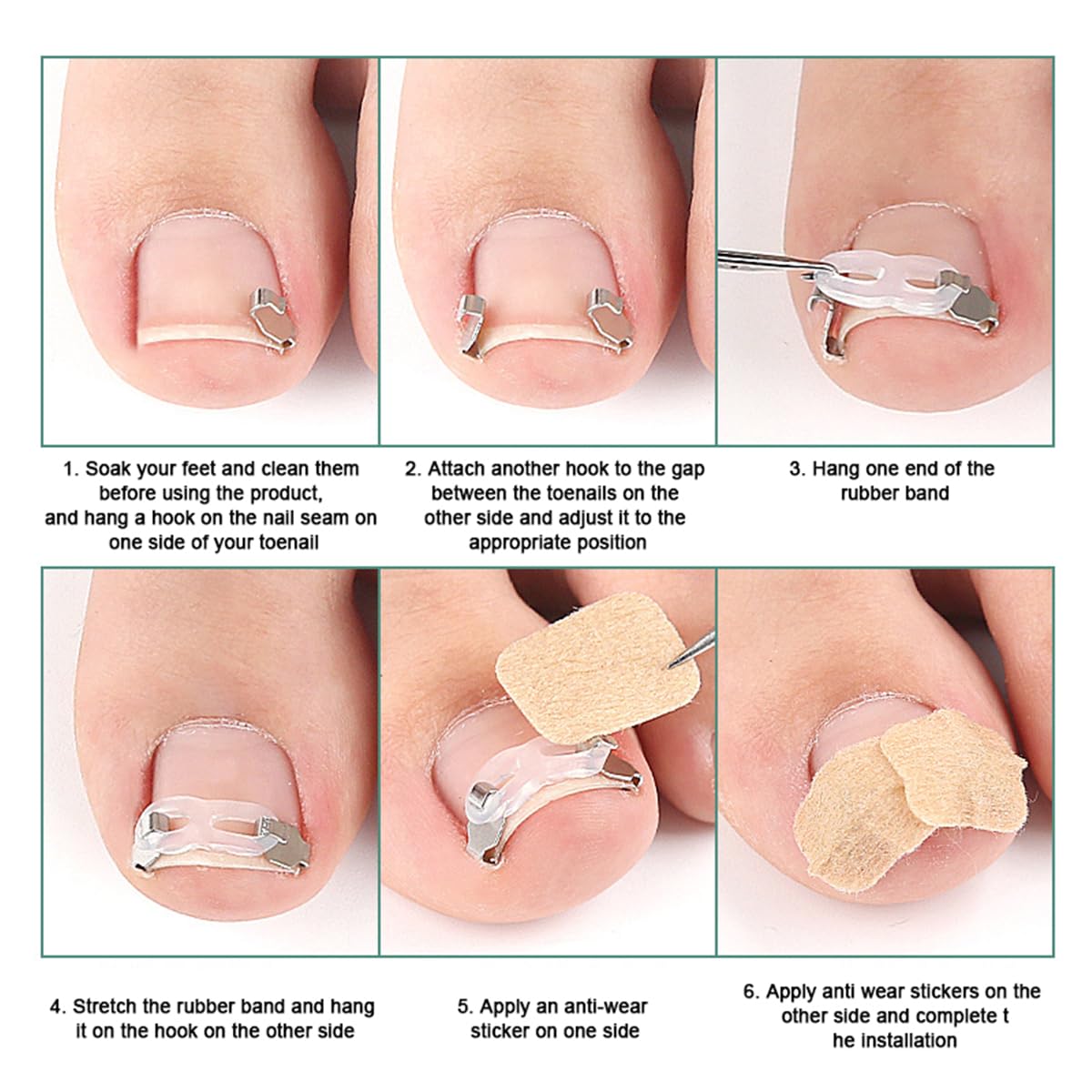 Ingrown Toenail Correction Tool Set, 2 Stainless Steel Insert Clips Ingrown Toenail Treatment Elastic Silicone Strips Ingrowns Nail Corrector Patch Pedicure Tool Removal Kit for Curved Toe Nail Repair