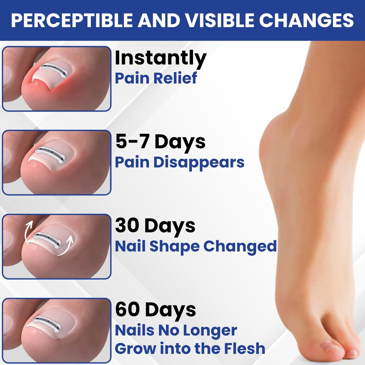 Premium Titanium Alloy Ingrown Toenail Corrector & Treatment Kit– Hypoallergenic Curved Toenail Corrector Strips– Toenail Straightener, Water-Resistant, Quick Relief, Easy Home Use, 10 Pcs in 4 Sizes